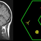 Image for article titled MRI Scans Can Reveal Whether You're a Good Gamer